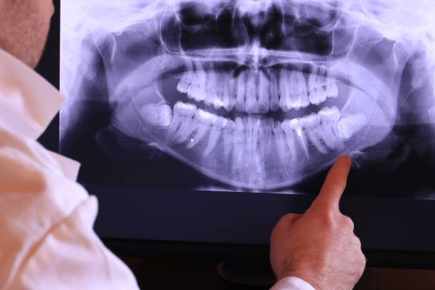 Best Broken or Chipped Tooth Repair in Westport, WA