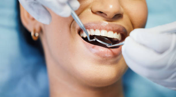 Best Emergency Treatment for Oral Infections in Westport, WA