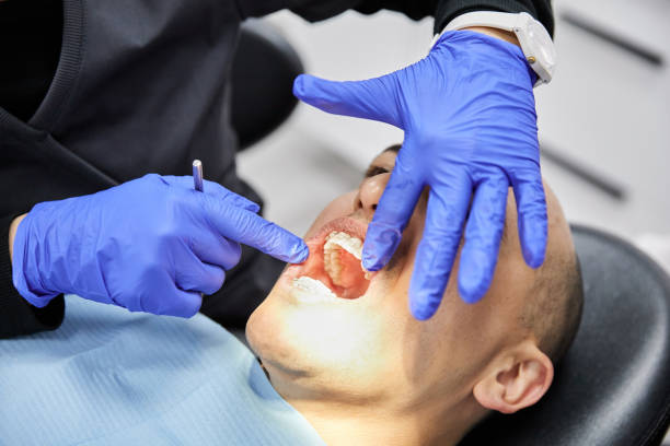 Best Emergency Root Canal Therapy in Westport, WA